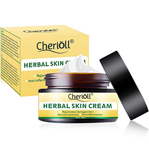 Crema para el cuerpo, tratamiento para la psoriasis, eccema, rosácea y dermatitis, la crema herbal china natural reduce la sequedad y la inflamación, el tratamiento para la piel con picazón