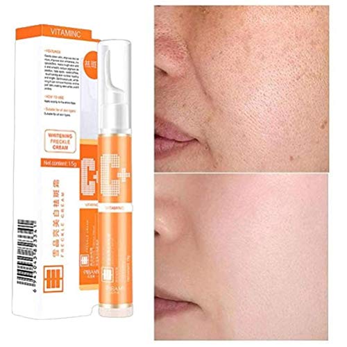 LifeBest 15g Crema blanqueadora Antimanchas VC Eliminación de Manchas de pecas Crema blanqueadora Tratamiento Facial antienvejecimiento para hiperpigmentación